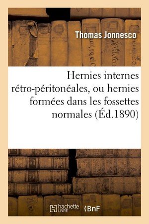 Hernies internes retro-peritoneales, ou hernies formees dans les fossettes normales du peritoine - :