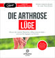 Die Arthrose-Lüge