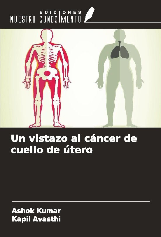 Un vistazo al cáncer de cuello de útero